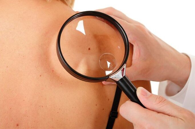 Examen de un paciente con VPH.