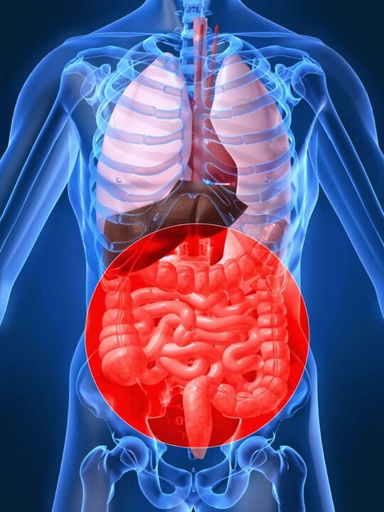 La disbiosis intestinal provoca la activación del virus del papiloma humano. 